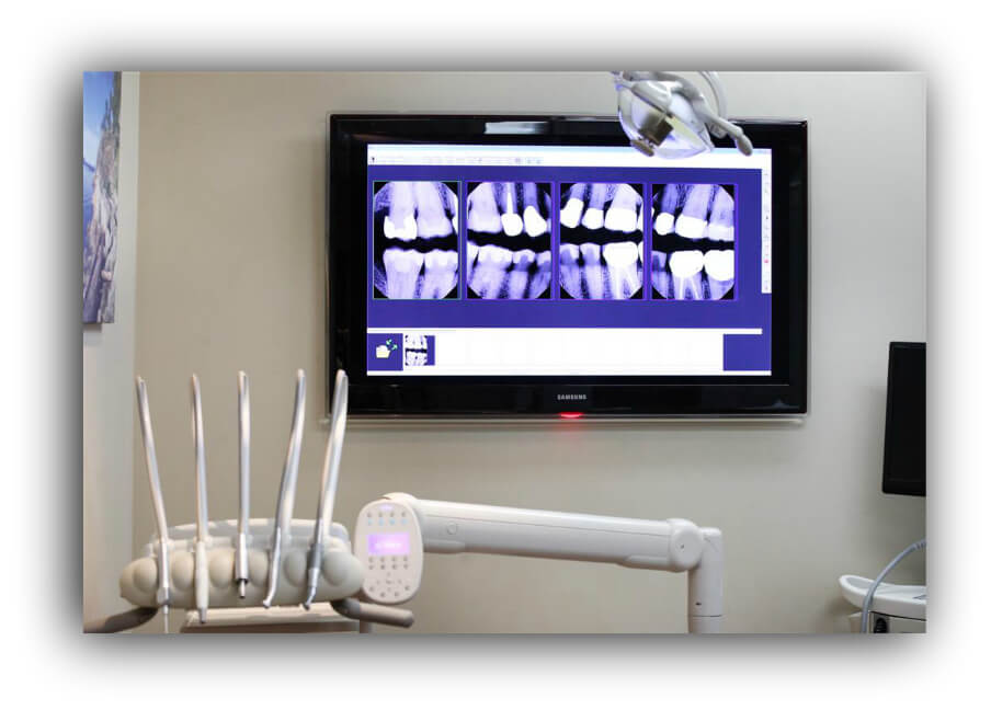 Dundarave Dental Clinic Xrays