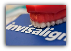 invisalign