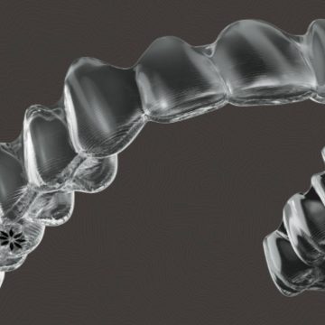 Why Clear Aligners with Invisalign Are a Game-Changer